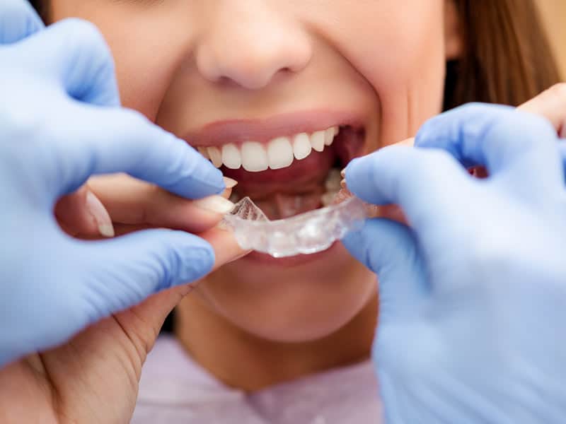orthodontics in victoria