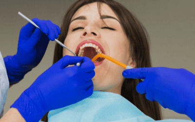 How Soon After Dental Cleaning Can I Eat?