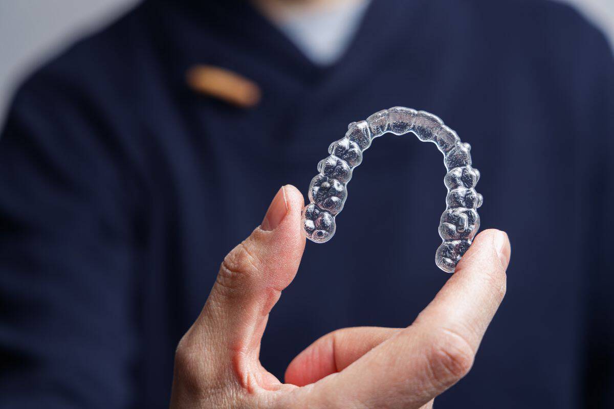 10 things to consider before starting invisalign treatment