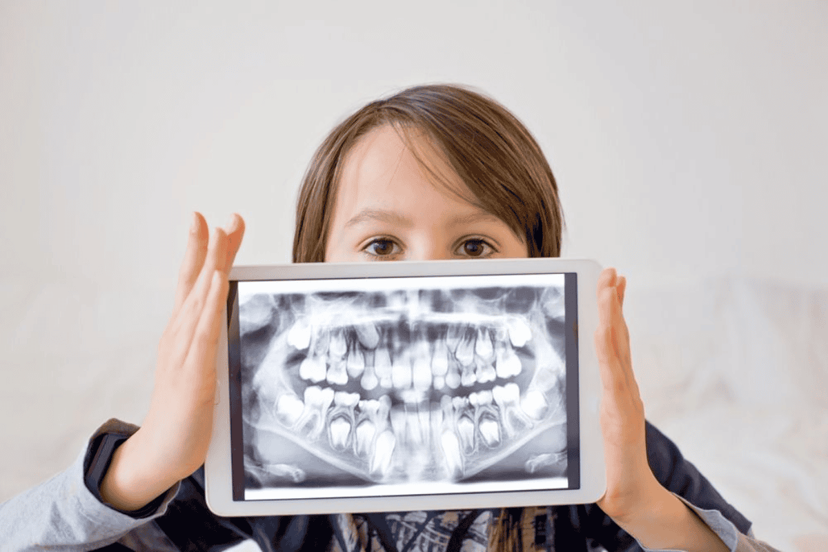 digital xrays and intra oral cameras