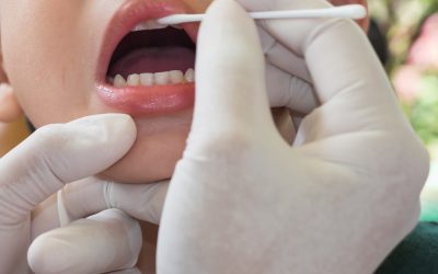 What is Fluoride Treatment, and What Are the Benefits?