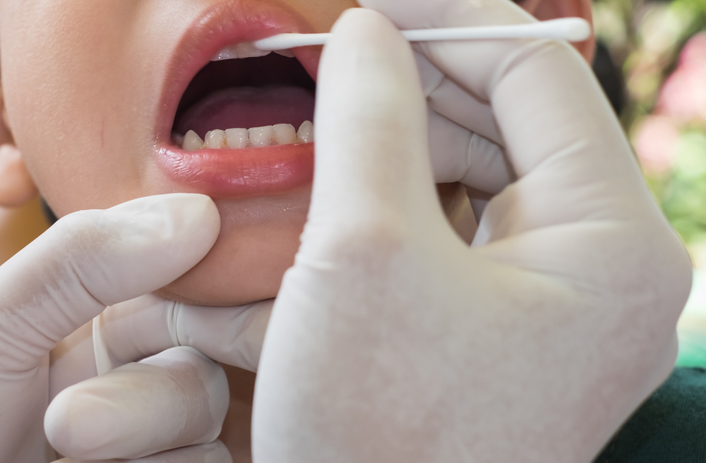 what is fluoride treatment and what are the benefits