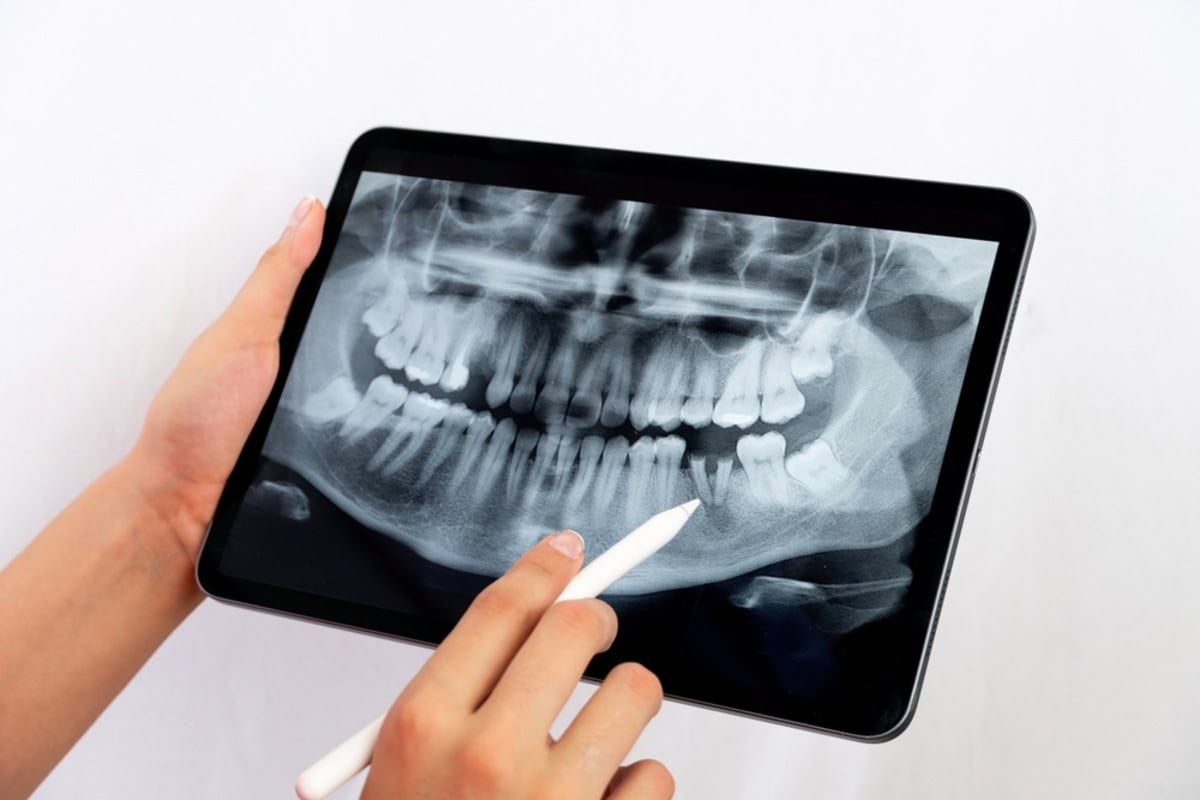 what can digital dental x rays detect that a visual exam can t