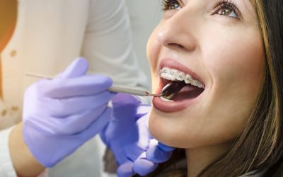 What Happens During a Comprehensive Dental Exam?