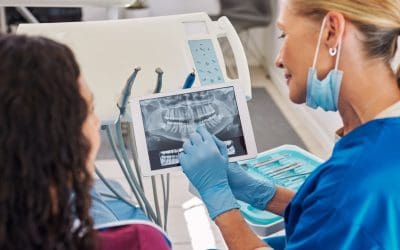 How Often Should You Get Full Dental X-Rays?